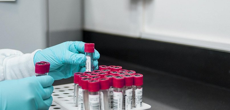 Probówki falcon i kriopudełka – od laboratorium diagnostycznego po szkolną pracown